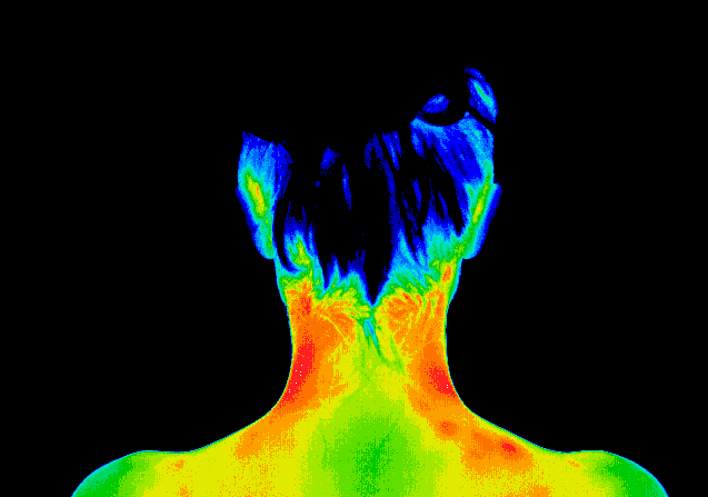 thermography of neck and shoulders