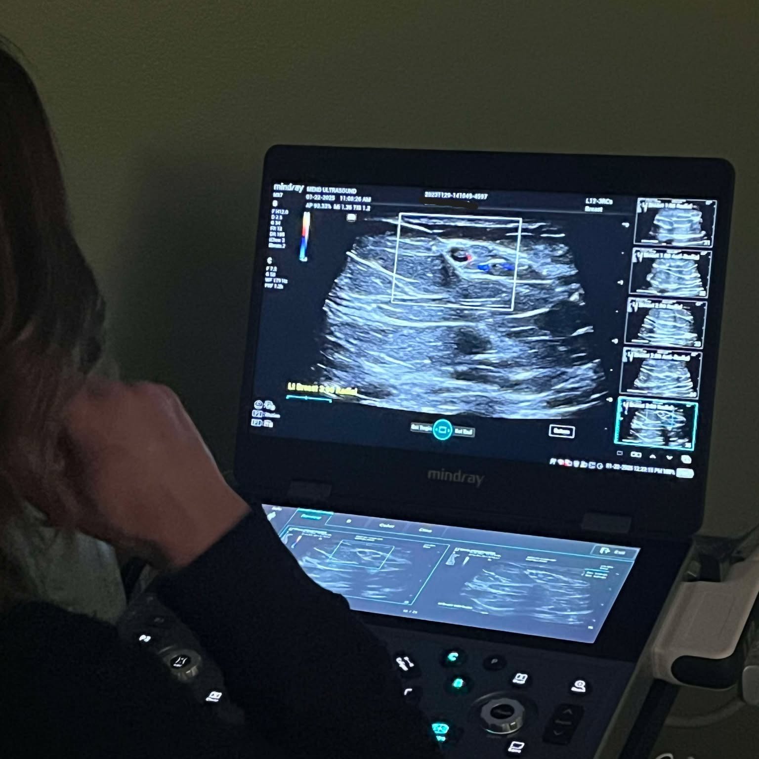 photo of ultrasound technologist looking at images