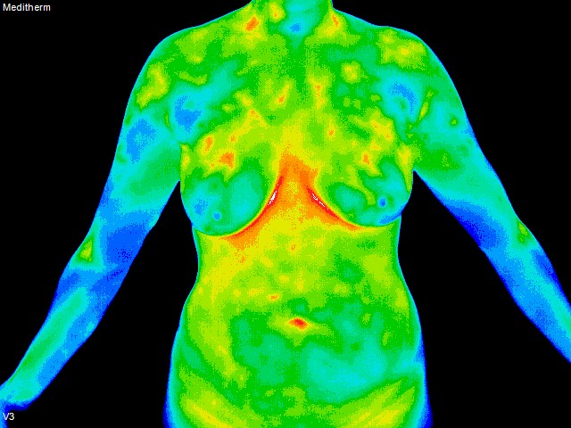 thermography of torso front